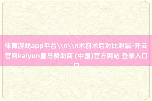 体育游戏app平台\n\n术前术后对比泄漏-开云官网kaiyun皇马赞助商 (中国)官方网站 登录入口